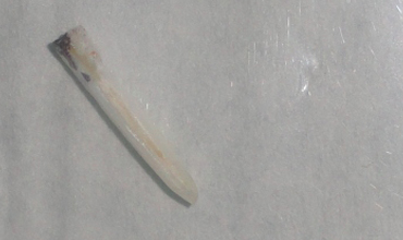 Teeth whitening in Anand
                        